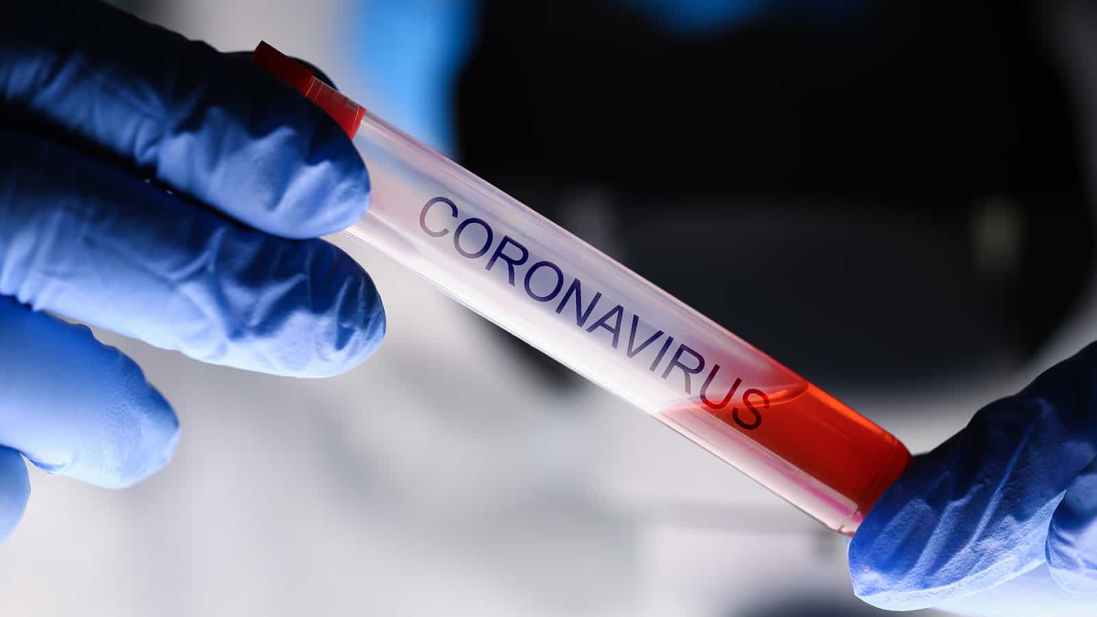 exposed to coronavirus